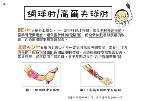 手指頭受傷|手肘痛、手腕痛、手指痛的原因,治療與自我檢查 » 台。